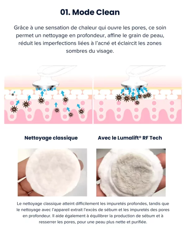 LumaLift® RF Tech – Image 5